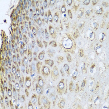 Immunofluorescence analysis of U2OS cells using RCAN1 Polyclonal Antibody
