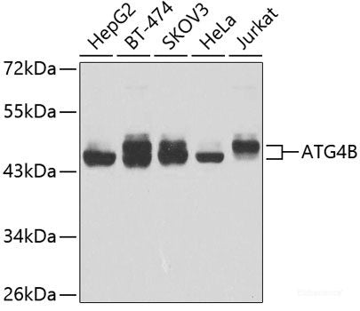 Western blot analysis of extracts of 293T cells using ABCA6 Polyclonal Antibody.