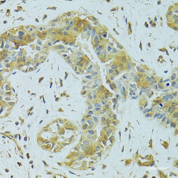 Immunofluorescence analysis of U2OS cells using HYLS1 Polyclonal Antibody at dilution of 1:100. Blue: DAPI for nuclear staining.