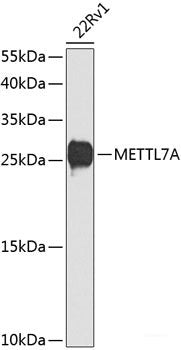 Western blot analysis of extracts of MCF-7 cells using GBA Polyclonal Antibody at dilution of 1:1000.