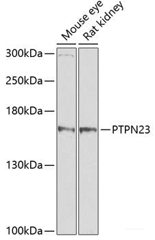 Western blot analysis of extracts of various cell lines using PSME1 Polyclonal Antibody at dilution of 1:1000.