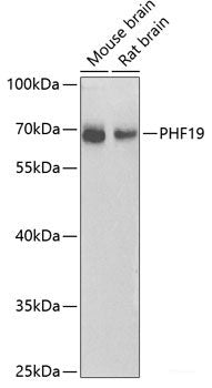 Immunohistochemistry of paraffin-embedded Human esophagus using STXBP4 Polyclonal Antibody at dilution of 1:100 (40x lens).