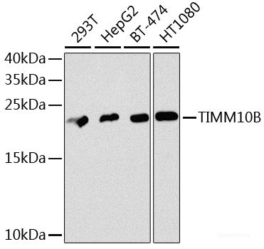 Western blot analysis of extracts of U-87MG cells using GPM6A Polyclonal Antibody at dilution of 1:1000.