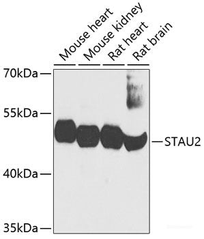 Western blot analysis of extracts of various cell lines using TMOD1 Polyclonal Antibody at dilution of 1:1000.