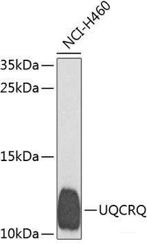 Western blot analysis of extracts from Mouse brain tissue using Phospho-Tau(S396) Polyclonal Antibody.