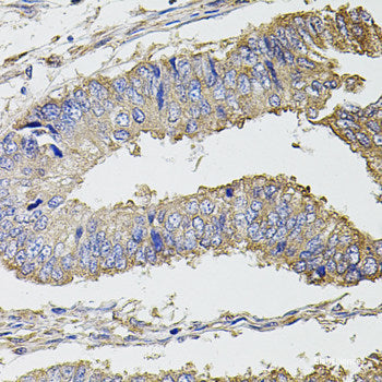 Immunohistochemistry of paraffin-embedded Human colon using AZGP1 Polyclonal Antibody at dilution of 1:100 (40x lens).