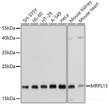 Immunohistochemistry of paraffin-embedded Rat liver using OXA1L Polyclonal Antibody at dilution of 1:100 (40x lens).