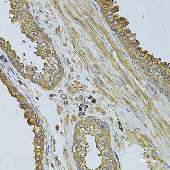 Immunofluorescence analysis of U2OS cells using PNOC Polyclonal Antibody