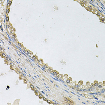Immunofluorescence analysis of U2OS cells using Phospho-MET(Y1003) Polyclonal Antibody