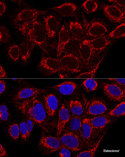 Western blot analysis of extracts from Mouse Brain tissue using Phospho-GRIN1(S896) Polyclonal Antibody.
