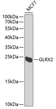 Immunohistochemistry of paraffin-embedded Human colon carcinoma using SURF1 Polyclonal Antibody at dilution of 1:100 (40x lens).