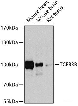 Western blot analysis of extracts of various cell lines using RLBP1 Polyclonal Antibody at dilution of 1:1000.