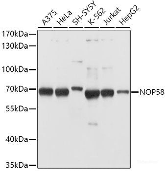 Western blot analysis of extracts of various cell lines using Nectin 2/CD112 Polyclonal Antibody at dilution of 1:1000.