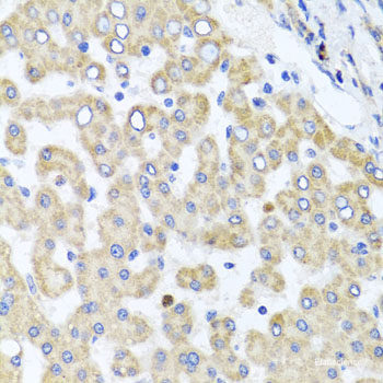 Immunohistochemistry of paraffin-embedded Mouse brain using GNE Polyclonal Antibody at dilution of 1:100 (40x lens).