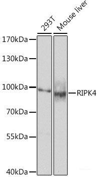 Immunofluorescence analysis of HeLa cells using EPB41L2 Polyclonal Antibody at dilution of 1:100. Blue: DAPI for nuclear staining.