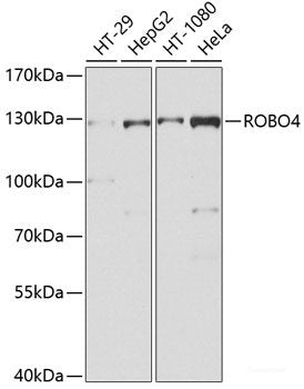 Immunohistochemistry of paraffin-embedded Rat hippocampal region tissue from a model with Alzheimer, using Phospho-Tau(S404) Polyclonal Antibody