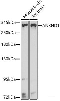 Immunohistochemistry of paraffin-embedded Mouse lung using MARK1 Polyclonal Antibody at dilution of 1:100 (40x lens).