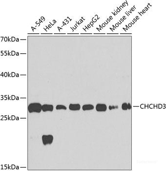 Western blot analysis of extracts of various cell lines using ST8SIA1 Polyclonal Antibody at dilution of 1:3000.