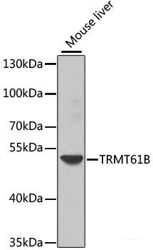 Immunohistochemistry of paraffin-embedded Rat lung using RSPO1 Polyclonal Antibody at dilution of 1:100 (40x lens).