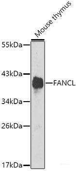 Immunofluorescence analysis of U2OS cells using ZNF217 Polyclonal Antibody