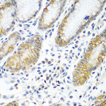 Western blot analysis of extracts of Mouse brain using NEFH Polyclonal Antibody at dilution of 1:1000.