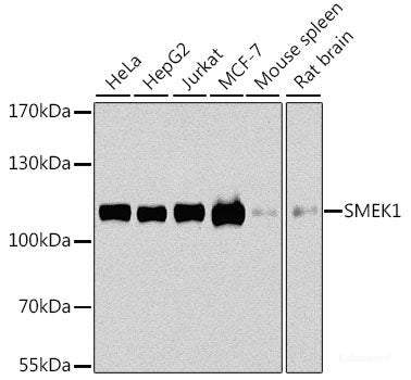 Western blot analysis of extracts of various cell lines using EXOSC4 Polyclonal Antibody at dilution of 1:3000.