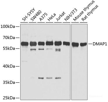 Western blot analysis of extracts of HeLa cells using KRT7 Polyclonal Antibody.