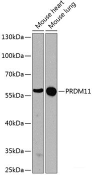 Immunofluorescence analysis of C6 cells using SNX15 Polyclonal Antibody at dilution of 1:100. Blue: DAPI for nuclear staining.
