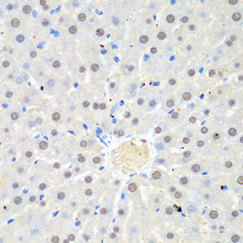 Immunohistochemistry of paraffin-embedded Rat liver using HIRIP3 Polyclonal Antibody at dilution of 1:100 (40x lens).