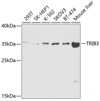 Western blot analysis of extracts of various cell lines using CPB2 Polyclonal Antibody at dilution of 1:1000.