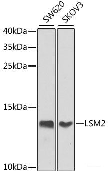 Immunohistochemistry of paraffin-embedded Human liver damage using TTLL12 Polyclonal Antibody at dilution of 1:100 (40x lens).