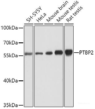 Western blot analysis of extracts of various cell lines using YEATS4 Polyclonal Antibody at dilution of 1:1000.