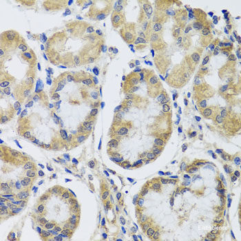 Immunofluorescence analysis of U2OS cells using PCCB Polyclonal Antibody