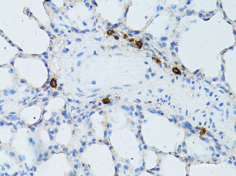 Immunohistochemistry of paraffin-embedded Human lung using C1QC Polyclonal Antibody at dilution of 1:100 (40x lens).