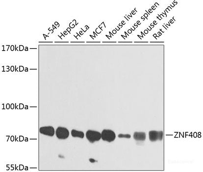 Immunohistochemistry of paraffin-embedded Human lung using COL6A1 Polyclonal Antibody at dilution of 1:100 (40x lens).