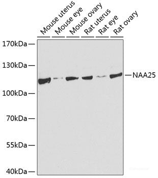 Western blot analysis of extracts of various cell lines using ROGDI Polyclonal Antibody at dilution of 1:3000.