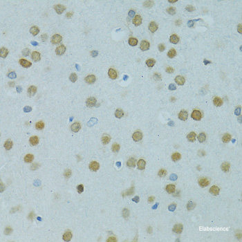 Immunofluorescence analysis of HeLa cells using EPM2A Polyclonal Antibody