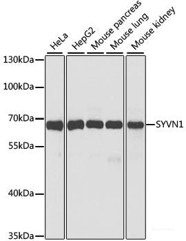 Western blot analysis of extracts of HeLa cells using PXN Polyclonal Antibody.