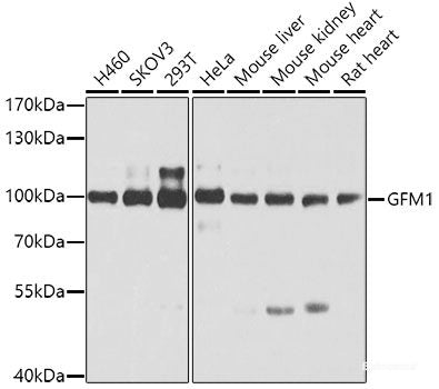 Immunofluorescence analysis of A549 cells using MCM10 Polyclonal Antibody
