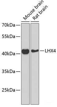 Western blot analysis of extracts of Rat brain using GTF2H2C_2 Polyclonal Antibody at dilution of 1:1000.