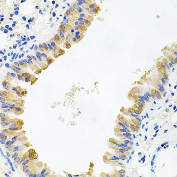 Immunofluorescence analysis of MCF7 cells using HBA1 Polyclonal Antibody