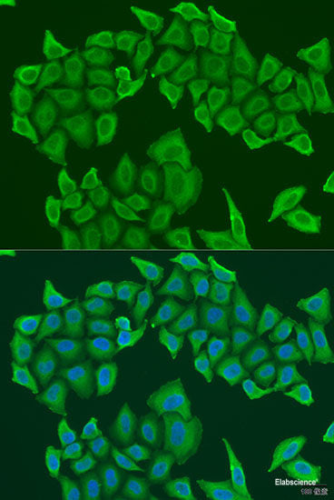 Western blot analysis of extracts of various cell lines using PHKB Polyclonal Antibody at dilution of 1:1000.