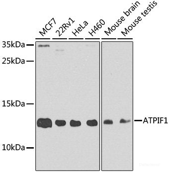 Western blot analysis of extracts of various cell lines using GARS Polyclonal Antibody at dilution of 1:5000.