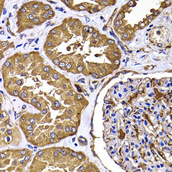 Immunohistochemistry of paraffin-embedded Human stomach using PIP4K2B Polyclonal Antibody at dilution of 1:100 (40x lens).