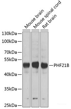 Western blot analysis of extracts of various cell lines using AHSA1 Polyclonal Antibody at dilution of 1:1000.