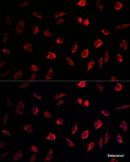 Immunohistochemistry of paraffin-embedded Rat kidney using RPS6KA3 Polyclonal Antibody at dilution of 1:100 (40x lens).