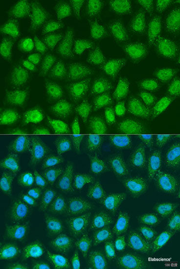 Western blot analysis of extracts of Jurkat cells using NIN Polyclonal Antibody at dilution of 1:1000.