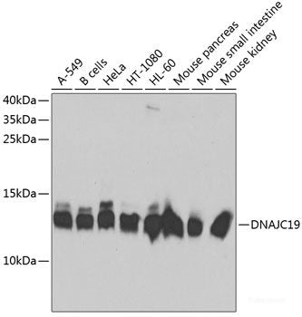 Immunofluorescence analysis of HeLa cells using TMSB4X Polyclonal Antibody
