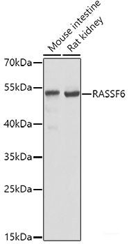 Immunofluorescence analysis of HeLa cells using EIF3E Polyclonal Antibody
