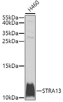 Western blot analysis of extracts of Jurkat cells using Phospho-STMN1(S25) Polyclonal Antibody at dilution of 1:2000.